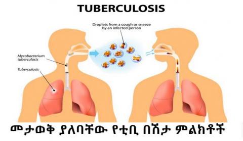 Signs And Symptoms Of Tuberculosis